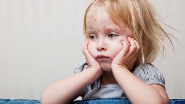 孩子手腳脫皮是為什么？如何防止冬天手腳脫皮？