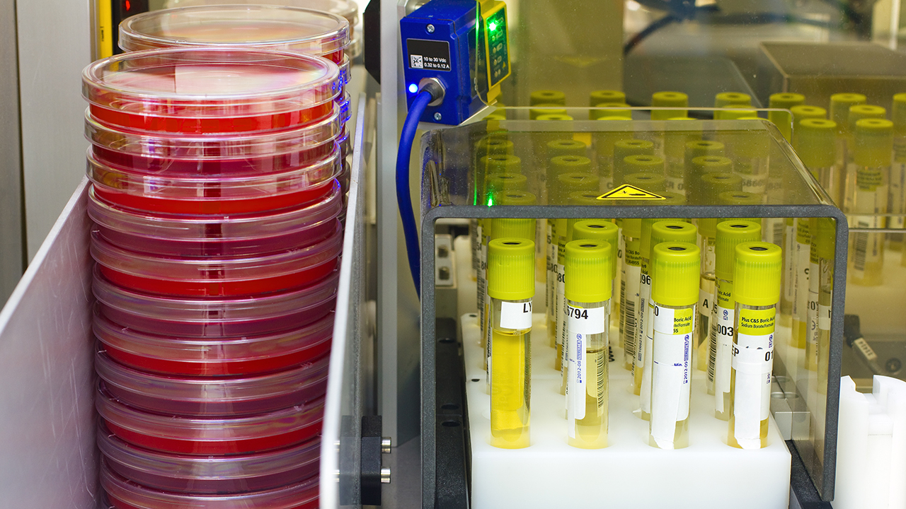 寶寶過敏性咳嗽怎么護理