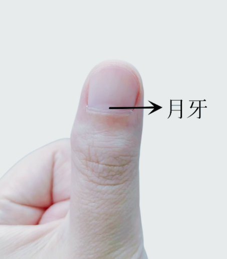 指甲出現(xiàn)一條黑線 別不當(dāng)回事！可能是癌變