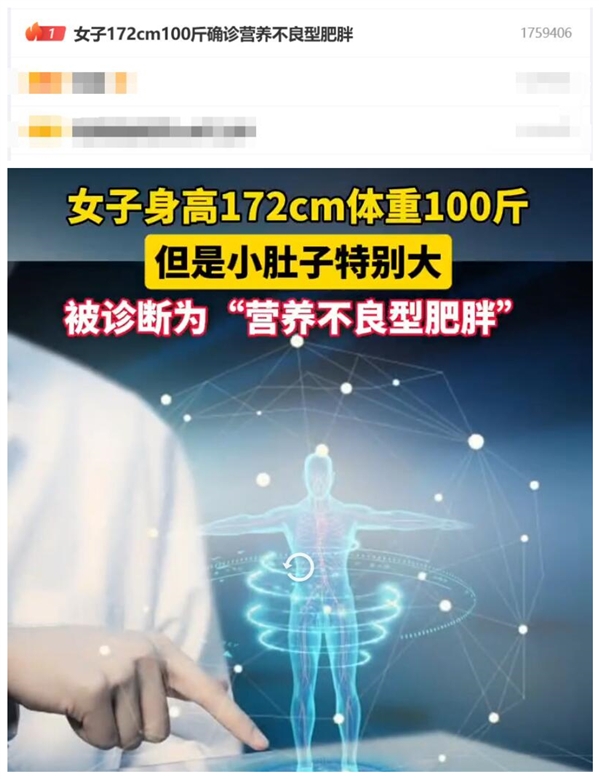 熱搜第一！女子172cm100斤確診營養(yǎng)不良型肥胖