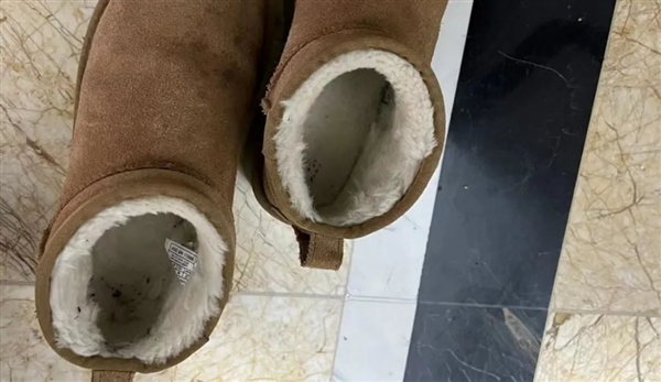 雪地靴又上熱搜！經(jīng)常穿真的很傷腳 醫(yī)生緊急提醒